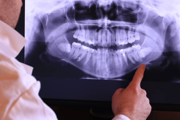 Best Emergency Dental Extractions in Fruitland, ID